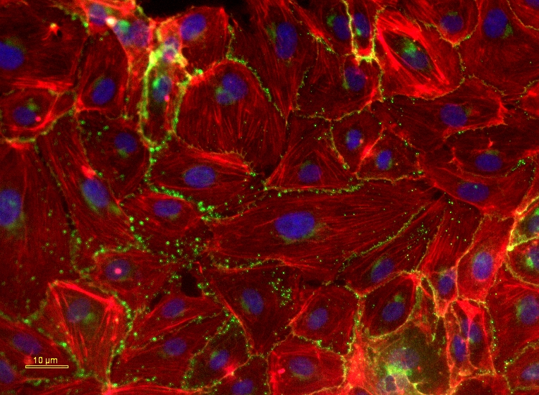 Endothelial_cells