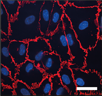 VE-cadherin staining