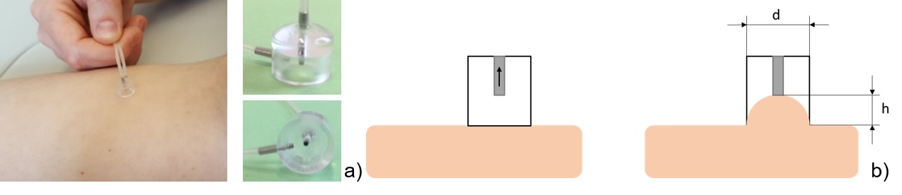 Suction-based measurement device