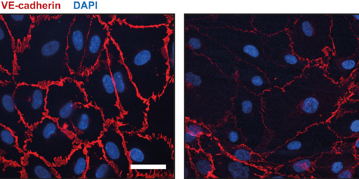 VE-cadherin staining of monolayer composed of young primary human kidney cells (left) and senescence cells (right)