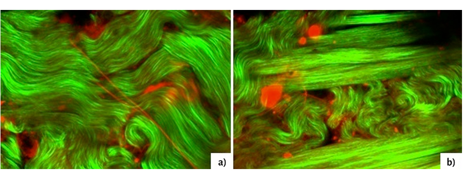 Multiphoton microscopy