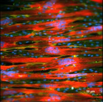 Fluorescent image of skeletal muscle tissue 